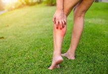 person holding calf with red irritated skin on a grassy lawn