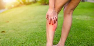 person holding calf with red irritated skin on a grassy lawn