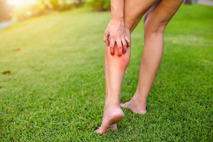 person holding calf with red irritated skin on a grassy lawn