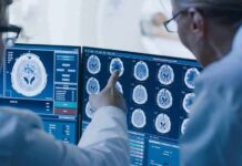 NYU Brain Blast Dials Down Delusions Doctors reviewing brain MRI scans on multiple monitors