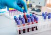 Pentagon Hormone Sweep Triggers Uproar Gloved hand holding a blood sample tube in a lab rack